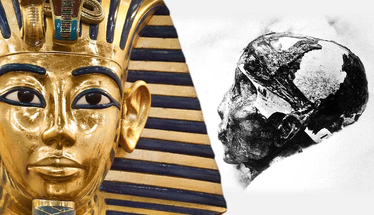 how did king tut die