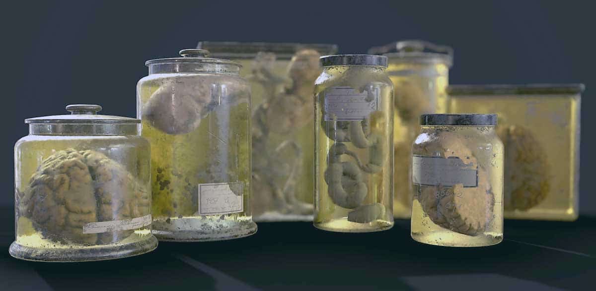 jack the ripper preserved organs