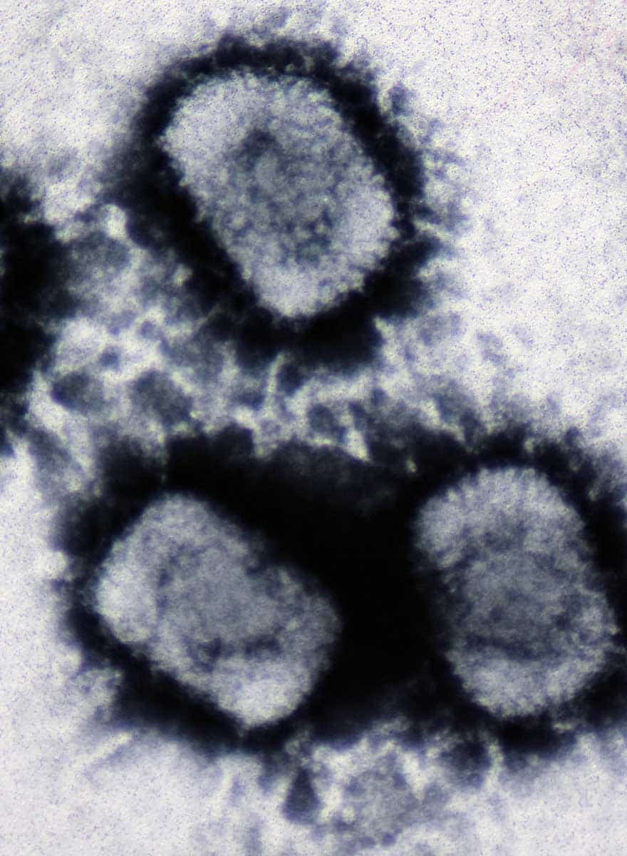 Cowpox virus